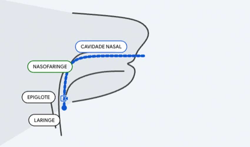 caminho do exame naso